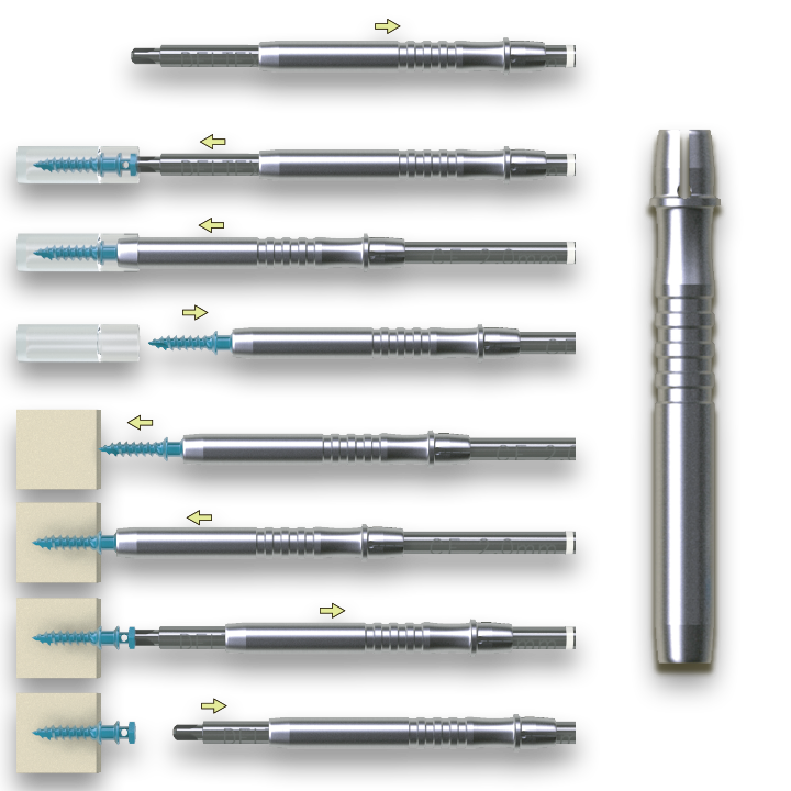 Minivis d'ancrage orthodontique DX-OMIA System